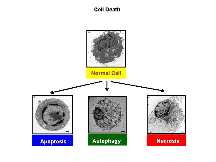 Cell Death Normal Cell Apoptosis Autophagy Necrosis 