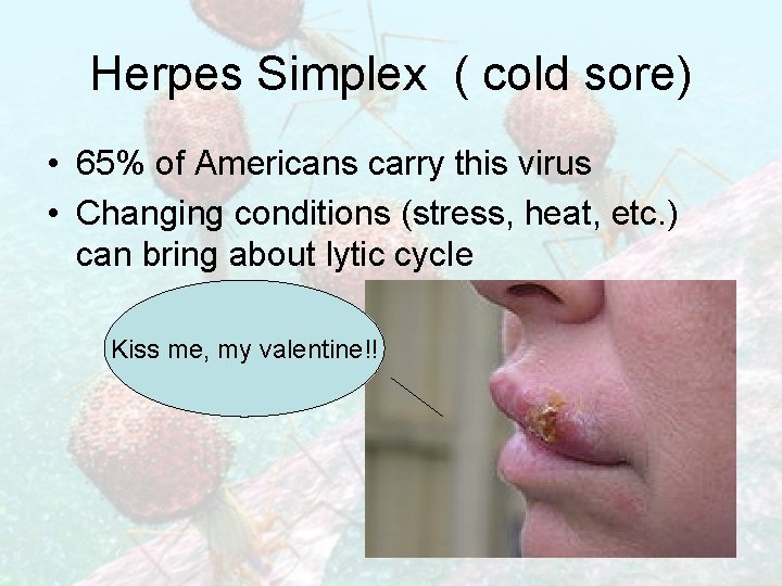 Herpes Simplex ( cold sore) • 65% of Americans carry this virus • Changing