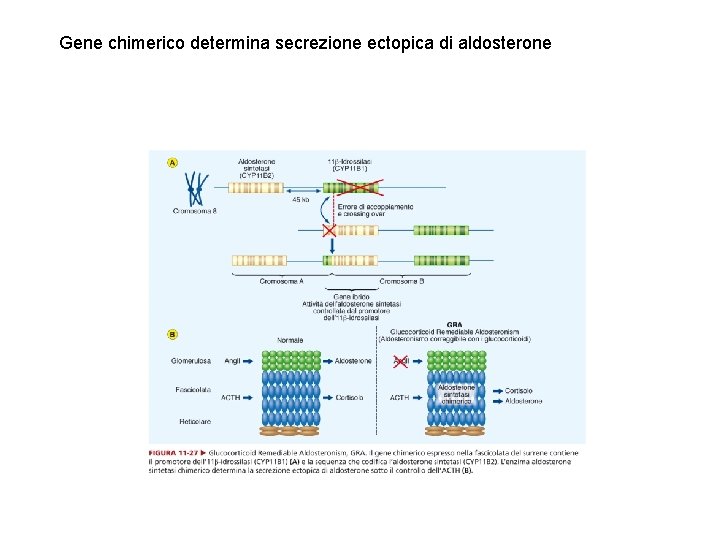Gene chimerico determina secrezione ectopica di aldosterone 