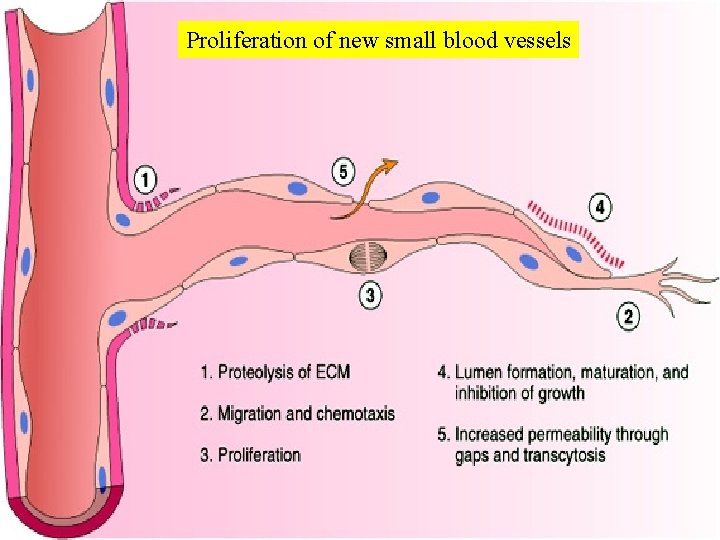 Proliferation of new small blood vessels 