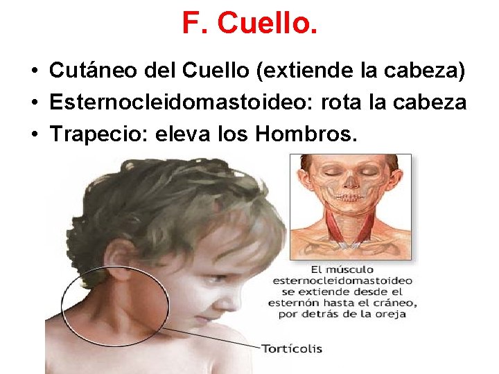 F. Cuello. • Cutáneo del Cuello (extiende la cabeza) • Esternocleidomastoideo: rota la cabeza