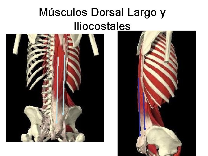 Músculos Dorsal Largo y Iliocostales 