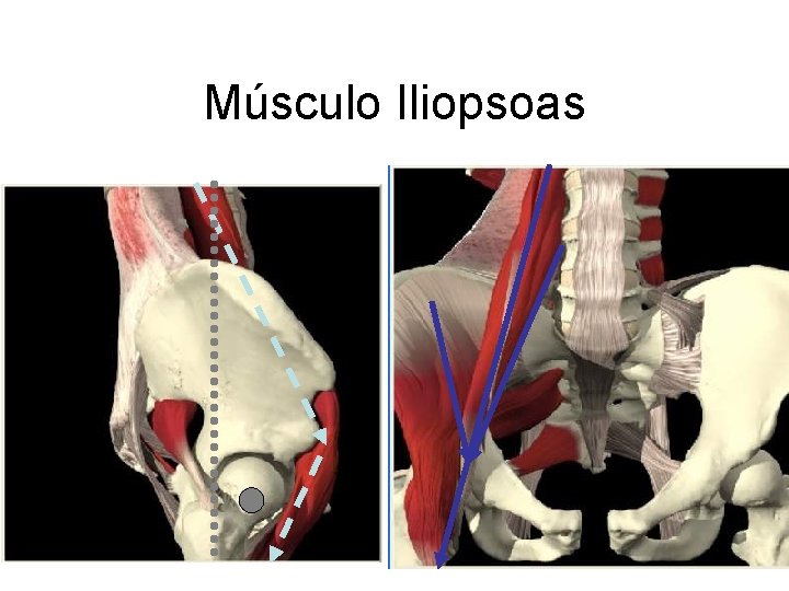 Músculo Iliopsoas 