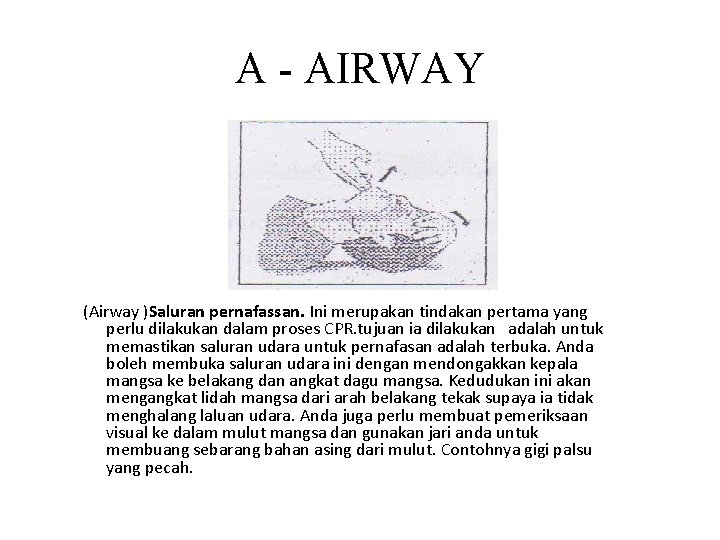 A - AIRWAY (Airway )Saluran pernafassan. Ini merupakan tindakan pertama yang perlu dilakukan dalam