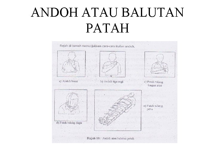 ANDOH ATAU BALUTAN PATAH 