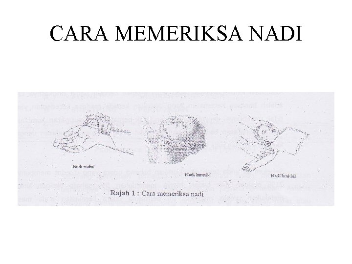 CARA MEMERIKSA NADI 