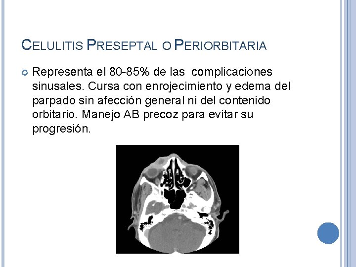 CELULITIS PRESEPTAL O PERIORBITARIA Representa el 80 -85% de las complicaciones sinusales. Cursa con