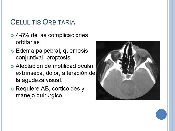 CELULITIS ORBITARIA 4 -8% de las complicaciones orbitarias. Edema palpebral, quemosis conjuntival, proptosis. Afectación