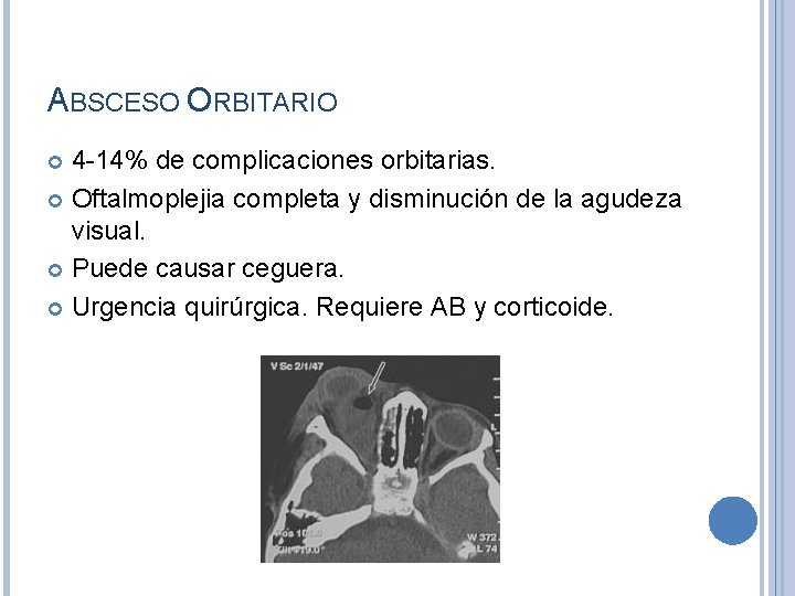 ABSCESO ORBITARIO 4 -14% de complicaciones orbitarias. Oftalmoplejia completa y disminución de la agudeza