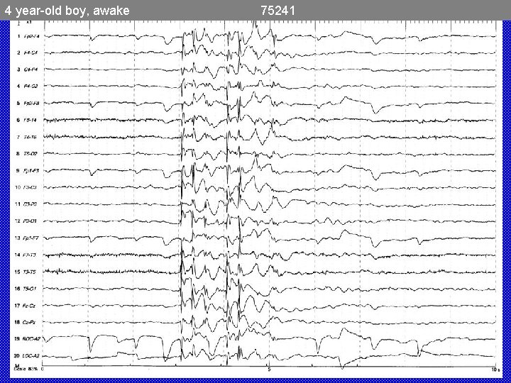 4 year-old boy, awake 75241 