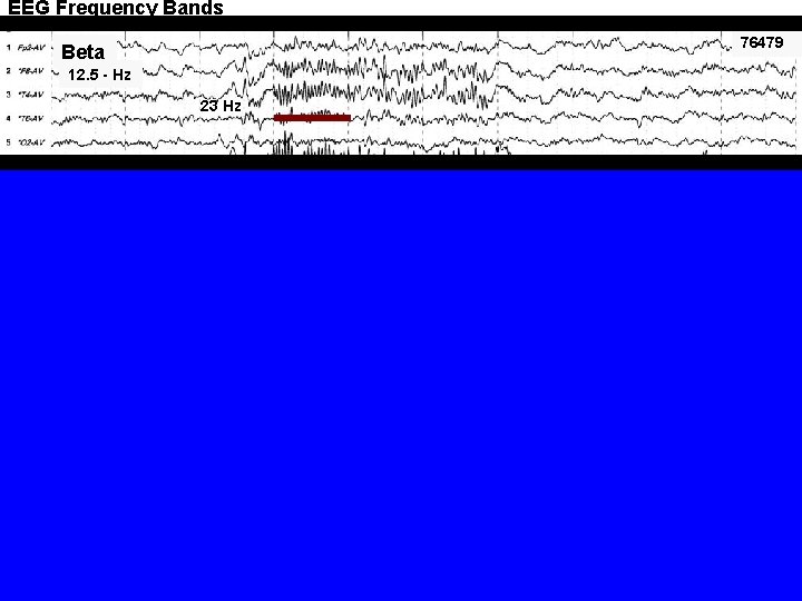 EEG Frequency Bands 76479 Beta 12. 5 - Hz 23 Hz 64279 Alpha 8