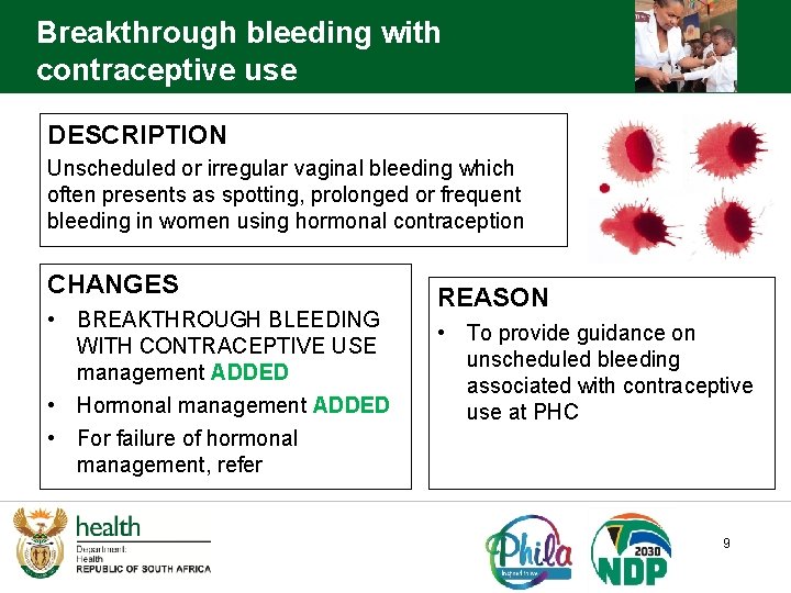 Breakthrough bleeding with contraceptive use DESCRIPTION Unscheduled or irregular vaginal bleeding which often presents