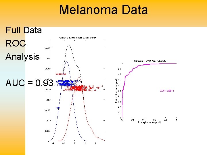Melanoma Data Full Data ROC Analysis AUC = 0. 93 