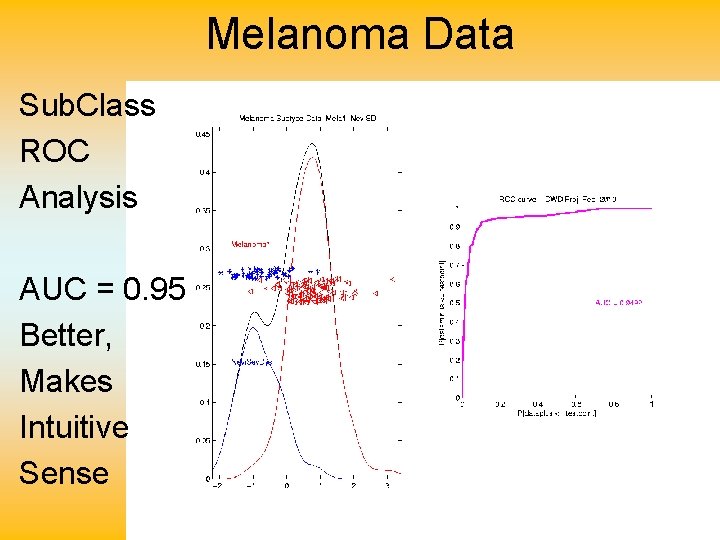 Melanoma Data Sub. Class ROC Analysis AUC = 0. 95 Better, Makes Intuitive Sense