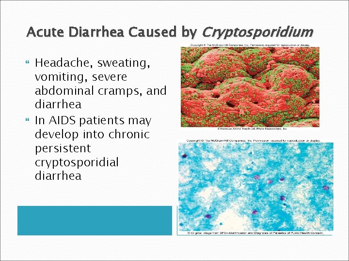 Acute Diarrhea Caused by Cryptosporidium Headache, sweating, vomiting, severe abdominal cramps, and diarrhea In