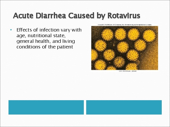 Acute Diarrhea Caused by Rotavirus • Effects of infection vary with age, nutritional state,