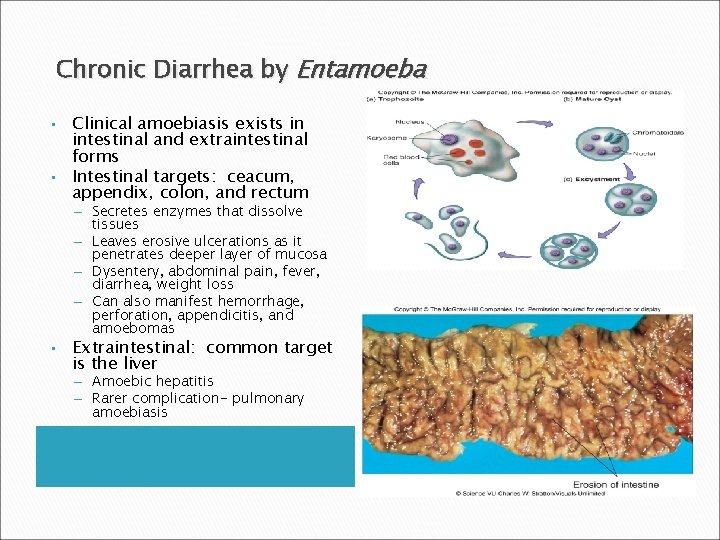 Chronic Diarrhea by Entamoeba • • Clinical amoebiasis exists in intestinal and extraintestinal forms