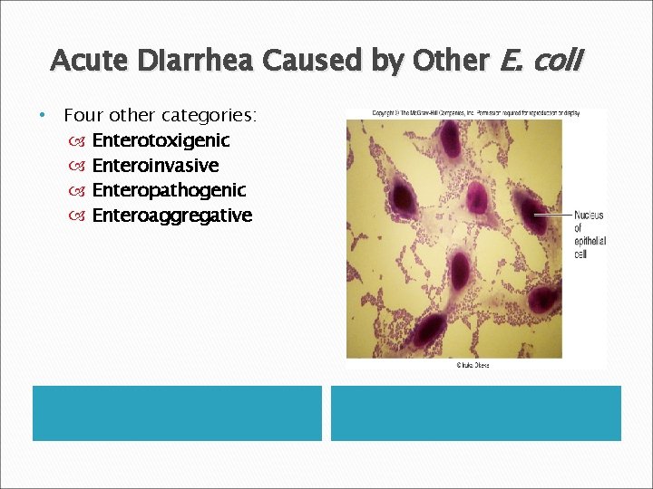 Acute Diarrhea Caused by Other E. coli • Four other categories: Enterotoxigenic Enteroinvasive Enteropathogenic