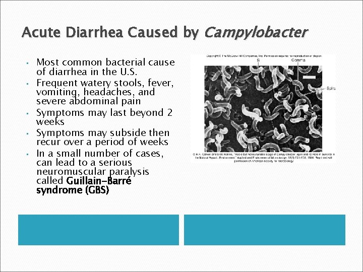 Acute Diarrhea Caused by Campylobacter • • • Most common bacterial cause of diarrhea
