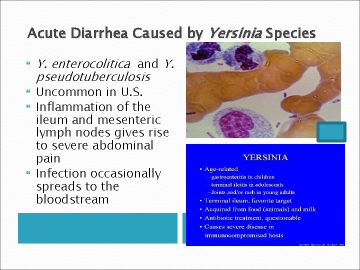 Acute Diarrhea Caused by Yersinia Species Y. enterocolitica and Y. pseudotuberculosis Uncommon in U.