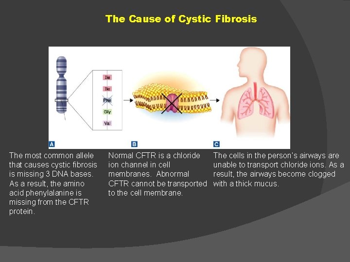 The Cause of Cystic Fibrosis The most common allele that causes cystic fibrosis is