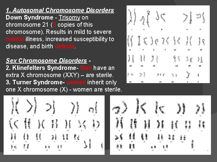 1. Autosomal Chromosome Disorders Down Syndrome - Trisomy on chromosome 21 (3 copies of