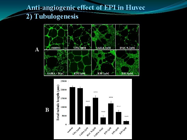 Anti-angiogenic effect of EPI in Huvec 2) Tubulogenesis A B 