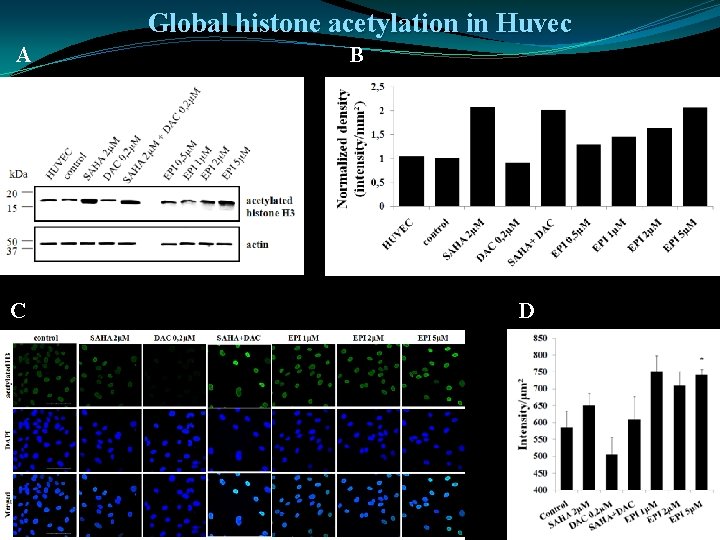 Global histone acetylation in Huvec A B C D E 