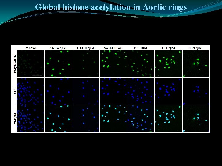 Global histone acetylation in Aortic rings 