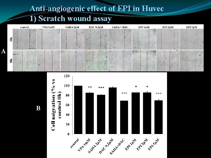 Anti-angiogenic effect of EPI in Huvec 1) Scratch wound assay A B 