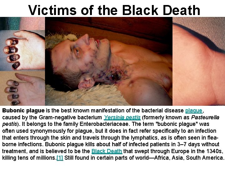 Victims of the Black Death Bubonic plague is the best known manifestation of the