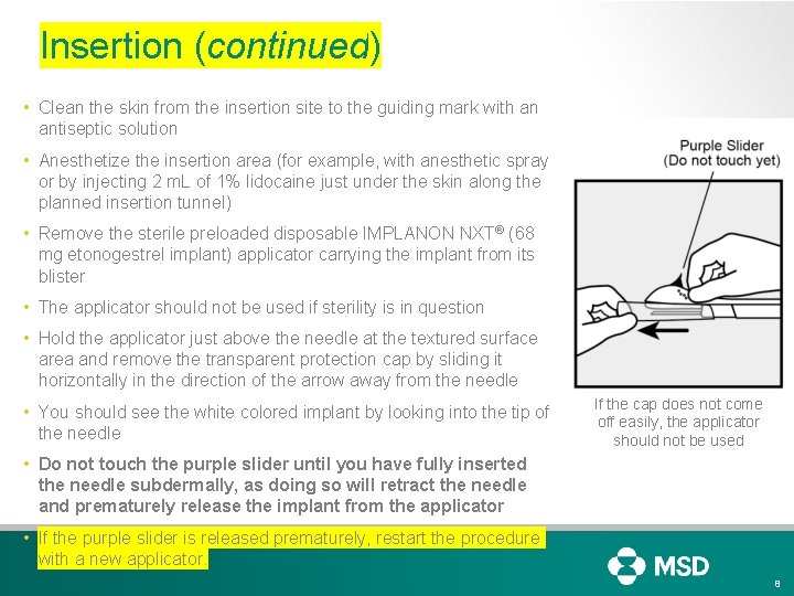 Insertion (continued) • Clean the skin from the insertion site to the guiding mark