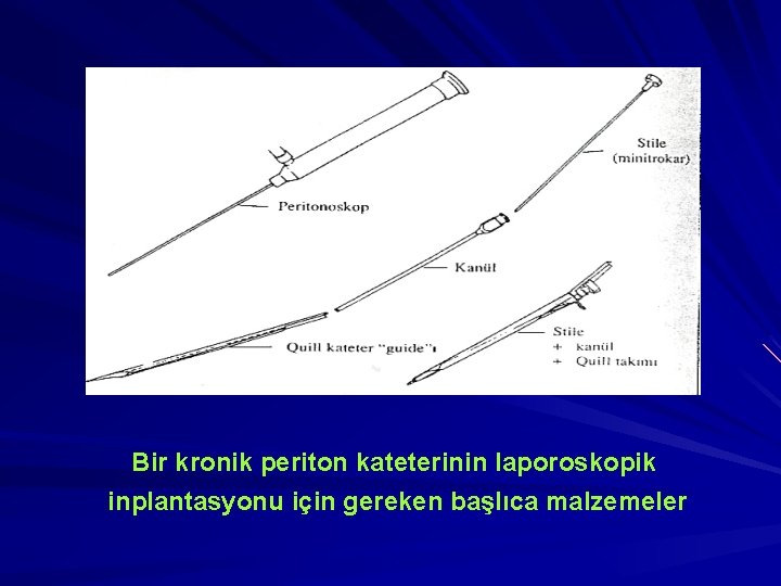 Bir kronik periton kateterinin laporoskopik inplantasyonu için gereken başlıca malzemeler 