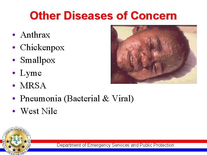 Other Diseases of Concern • • Anthrax Chickenpox Smallpox Lyme MRSA Pneumonia (Bacterial &