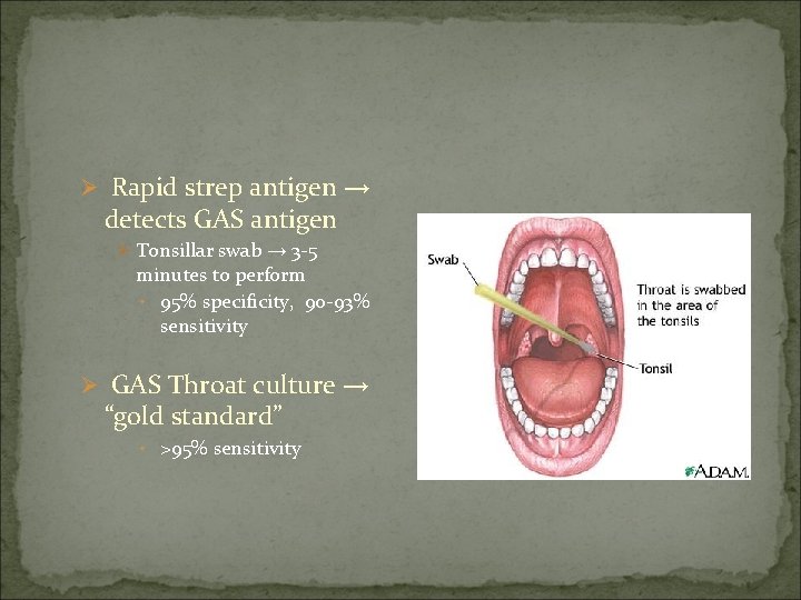 Ø Rapid strep antigen → detects GAS antigen Ø Tonsillar swab → 3 -5