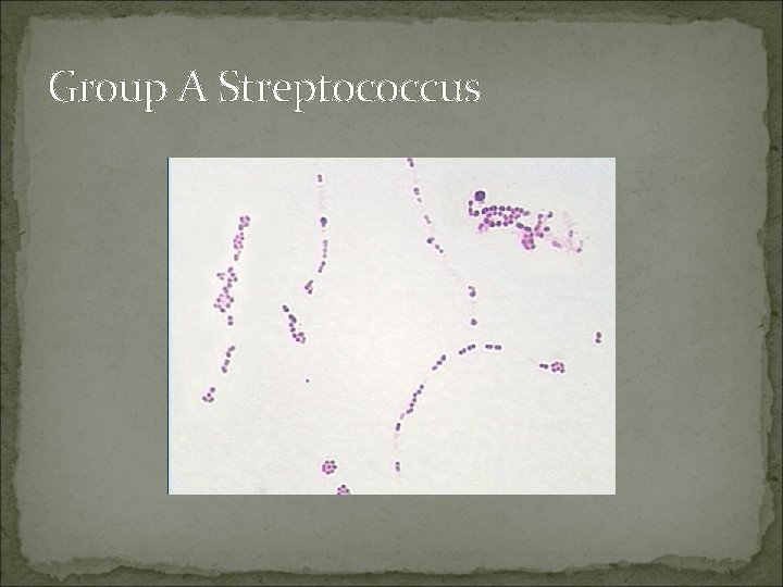 Group A Streptococcus 