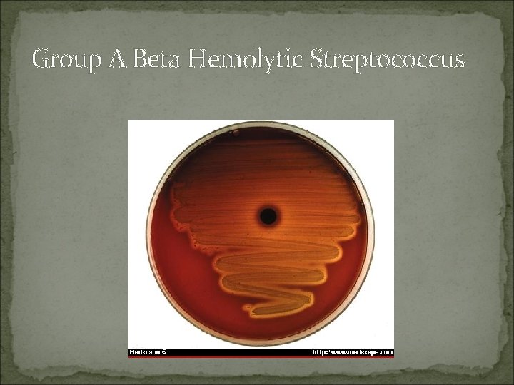 Group A Beta Hemolytic Streptococcus 