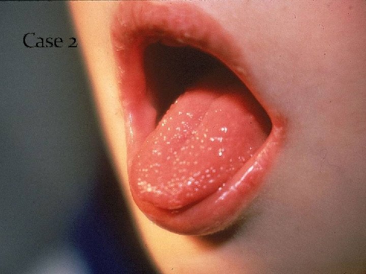 Case 2 