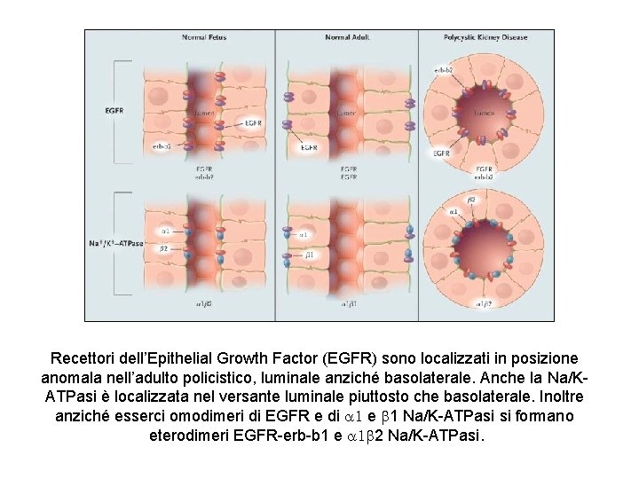 Recettori dell’Epithelial Growth Factor (EGFR) sono localizzati in posizione anomala nell’adulto policistico, luminale anziché Recettori dell’Epithelial Growth Factor (EGFR) sono localizzati in posizione anomala nell’adulto policistico, luminale anziché