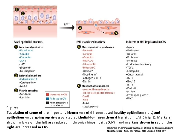 Figure: Tabulation of some of the important biomarkers of differentiated healthy epithelium (left) and