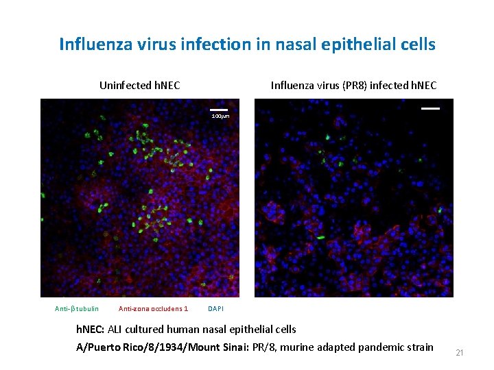 Influenza virus infection in nasal epithelial cells Uninfected h. NEC Influenza virus (PR 8)
