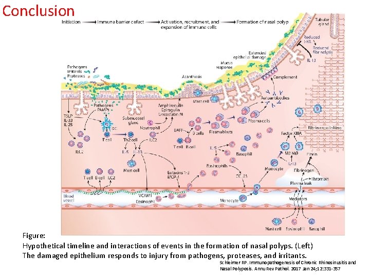 Conclusion Figure: Hypothetical timeline and interactions of events in the formation of nasal polyps.