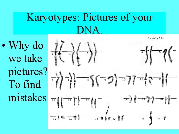 Karyotypes: Pictures of your DNA. • Why do we take pictures? To find mistakes