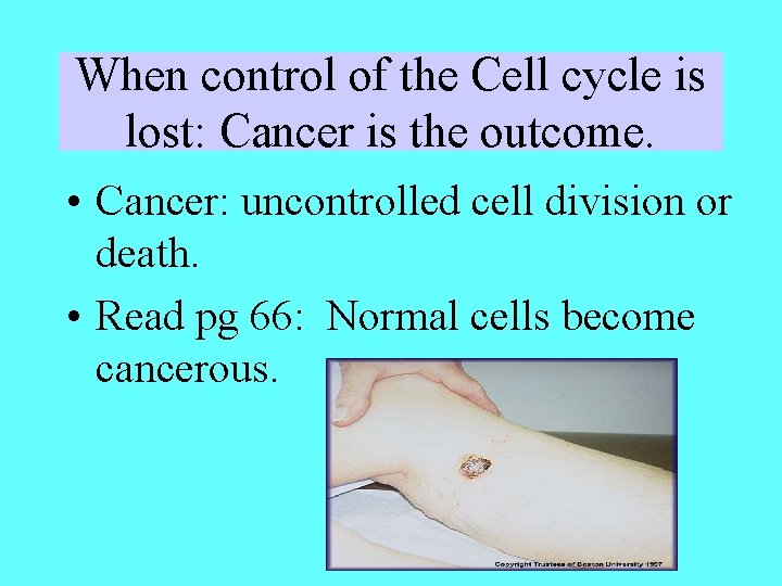 When control of the Cell cycle is lost: Cancer is the outcome. • Cancer: