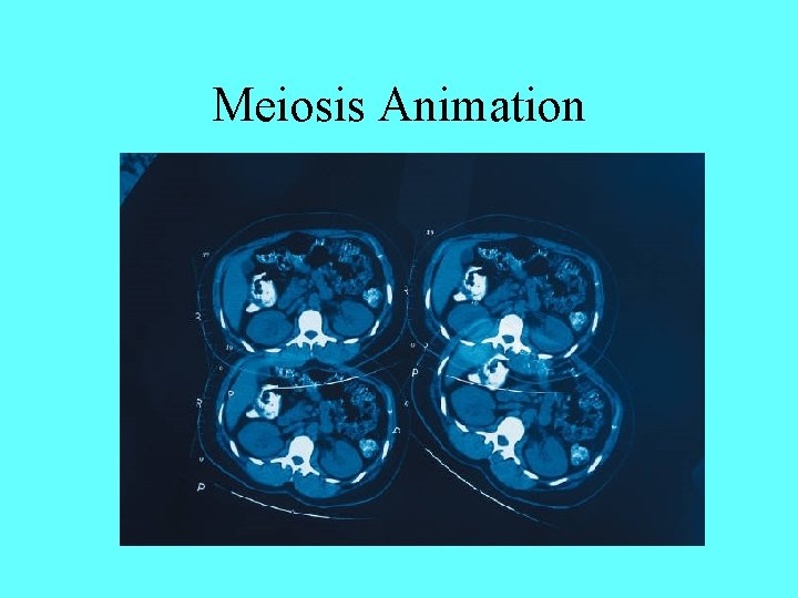 Meiosis Animation 