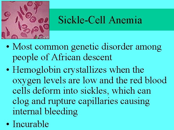 Sickle-Cell Anemia • Most common genetic disorder among people of African descent • Hemoglobin