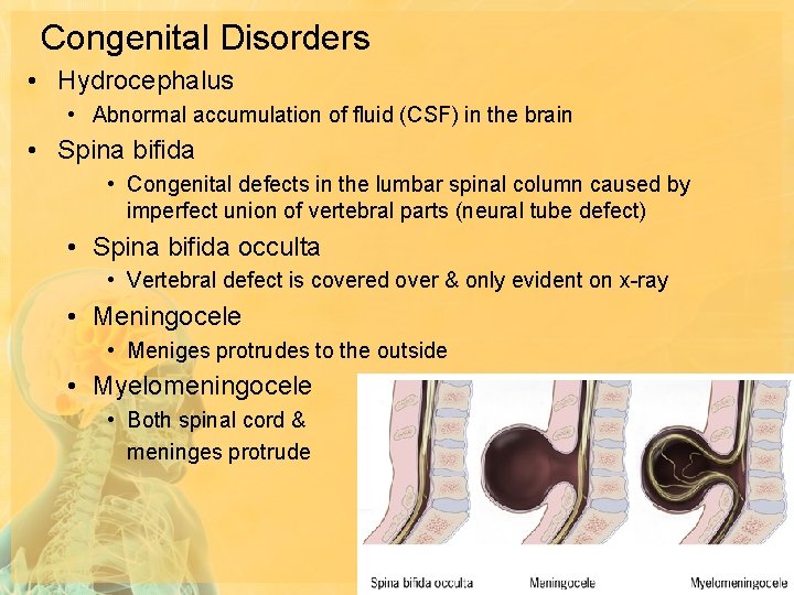 Congenital Disorders • Hydrocephalus • Abnormal accumulation of fluid (CSF) in the brain •