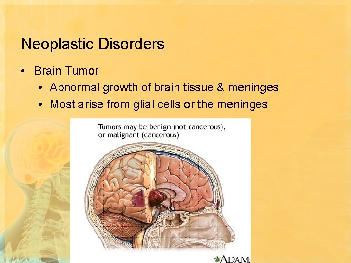 Neoplastic Disorders • Brain Tumor • Abnormal growth of brain tissue & meninges •