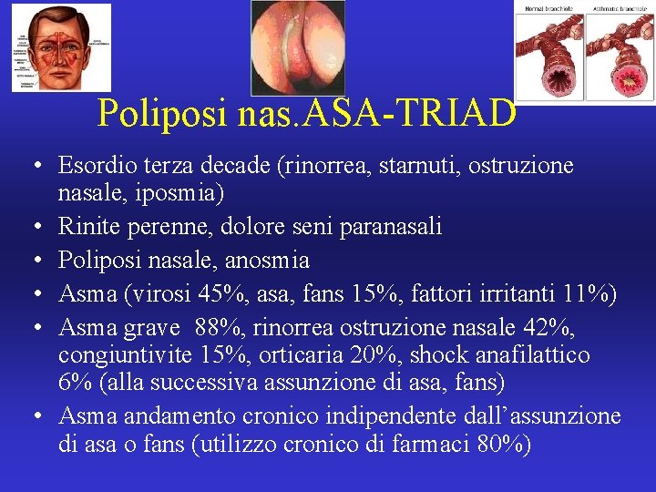 Poliposi nas. ASA-TRIAD • Esordio terza decade (rinorrea, starnuti, ostruzione nasale, iposmia) • Rinite