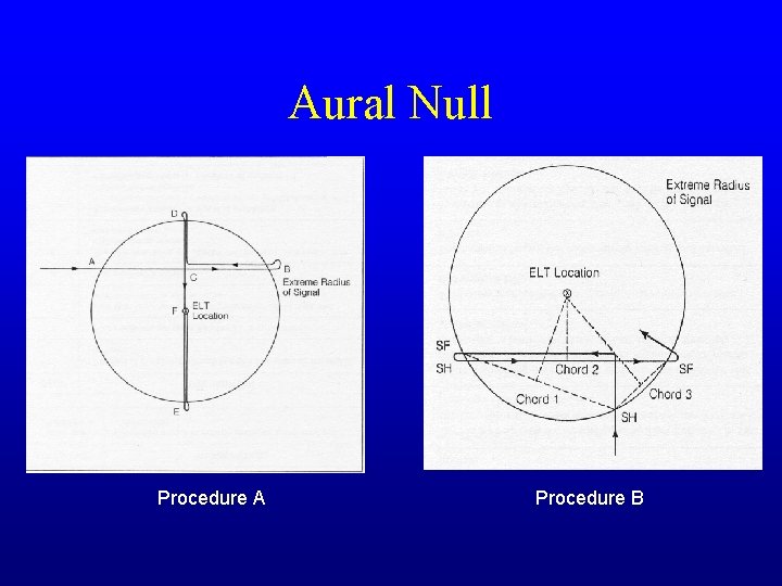 Aural Null Procedure A Procedure B 